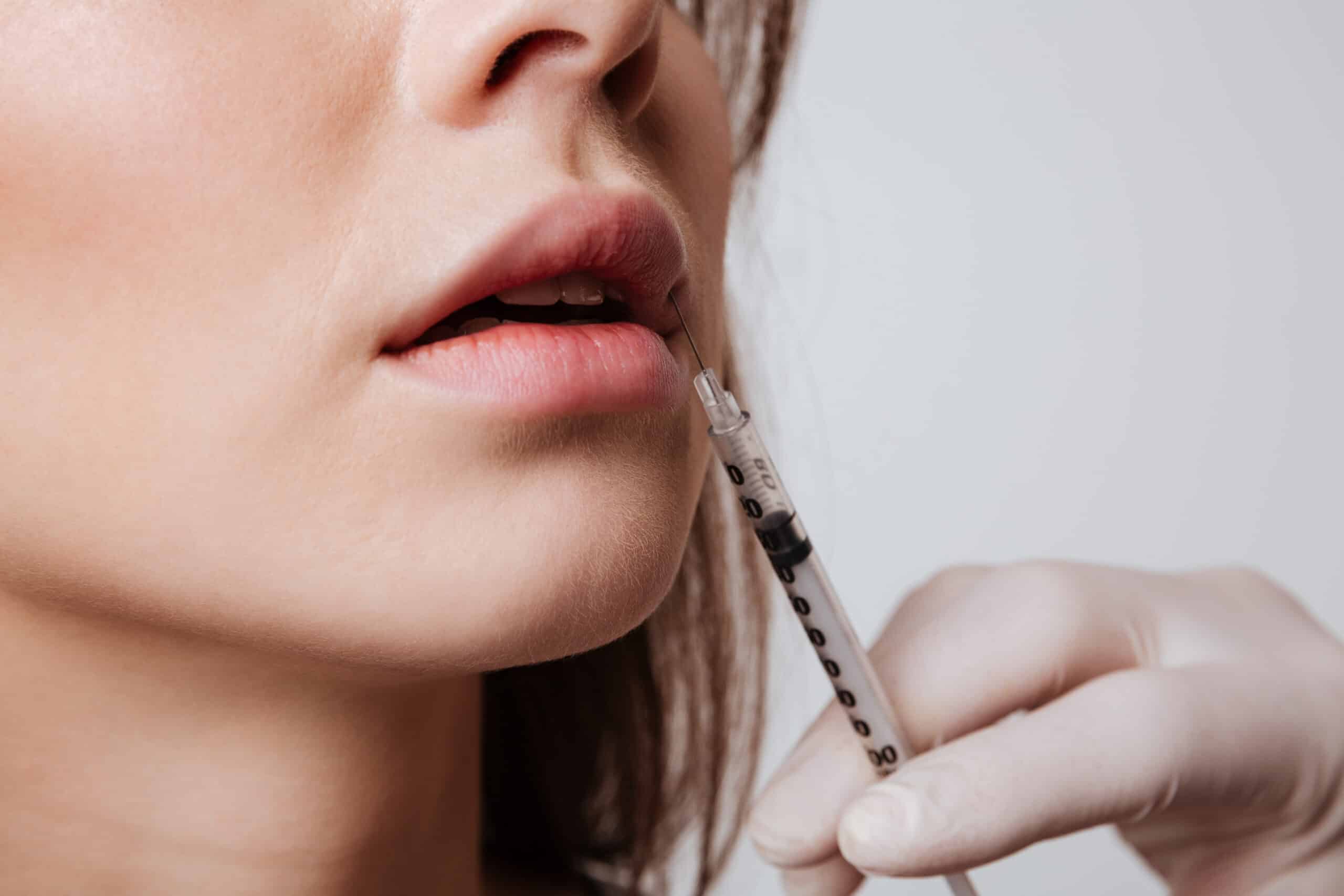 Lip Fillers and Age: Tailoring Treatments for Different Generations